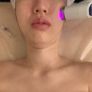 김포한강11로 | 김포피부관리 운양동 담온에스테틱 유산균앰플테라피 찐 만족후기