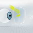 독일안경콘택트 이미지