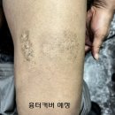 잉어 | 부천타투전문 허벅지 흉터커버업 잉어타투 후기