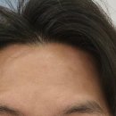 세르모소에스테틱 이미지