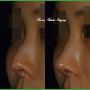 로코코성형외과의원 이미지