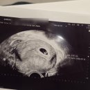 은평운수(주) | 소중한걸 알아요 💕가족 사랑💕 영2의 1월 소소일기 Pt.2