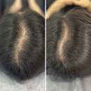 일번지 무인텔 | 광주헤어라인 자연스럽게 첨단에서 가르마두피커버 후기