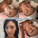 (주)웰티어 | 안양 윤곽관리 키웰 안양점 5회차 후기, 작은얼굴관리 전후 변화