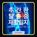 대한척추신기술연구학회 | [양방향 척추 내시경 감압술(UBE) 후기] 수술 후 1일~7일차 엄지발가락 · 발목 마비 재활 일지(1주 차)