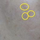 14-C | 마미케어 오쏘타민 비타민 C 앰플·크림 내돈내산 후기