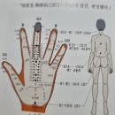 수지침 티스토리