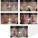 뉴케이의원 이미지