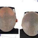 탈모왕 광주점 이미지