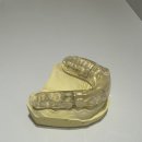 덴탈에이치과기공소 이미지