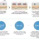 아톰미 이미지