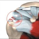 한마음정형외과의원 이미지