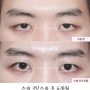 강남서연성형외과의원 이미지