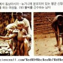 용성메디칼 네이버블로그