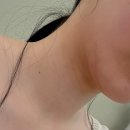 뷰리플한의원 | 안아픈 딥웨이브 리프팅으로 이중턱 관리하고온 후기 (압구정 뷰리플한의원)