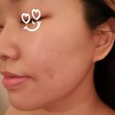 유샵뷰티 | 유샵뷰티_고통없는 하이푸리프팅 비포&에프터 후기♥(인모드 슈링크 고통 비교 / 가격 /남영역피부관리)