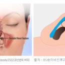 하늘성형외과의원 | 부산 코수술 성형외과 손품발품 실제 후기