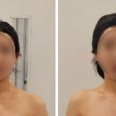 허치벨 이미지