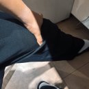 바디첵 | 전방십자인대 재건술 → 다리 누르기 &amp; 부분 핀 제거 → 완전 핀 제거까지, 452일 무릎 수술 후기