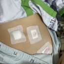 전주바른약국 | [약국추천템] 동아제약 스카논겔 - 흉터 연고...연고 내돈내산 사용기 근데 이제 맹장수술 후기를 곁들인