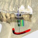 더프라임치과기공소 이미지
