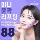 플라덴성형외과의원 | 미니 리프팅 가격