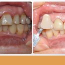 다이안치과기공소 이미지