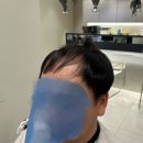 만모헤어 | 숱없는 남자머리 광주 남성증모술 남자증모술후기
