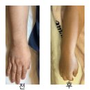 대진카센타 | [경기 광주] 프라이빗한 경기광주왁싱샵에서 팔 왁싱하고 온 후기! : 뽐왁싱 앤 뷰티
