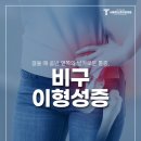 서울탑신경외과의원 | 개봉동 정형외과 오래 걸을 때 골반 옆쪽 아프다면? 비구 이형성증