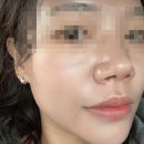 비바케어 | 첨단 피부관리 추천 비바뷰티하우스 프리미엄 스킨케어 후기