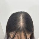 2007-주016 | [관리샵] 미사 두피 관리 전문 람스도트 5회 방문 후기!!