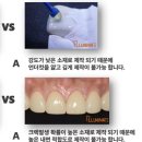 심미치과기공소 이미지