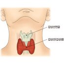 갑상선 기능 저하증 증상 이미지