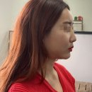 제이와이성형외과의원 이미지