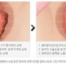 이제이포유