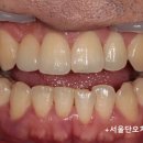 우주치과기공소 이미지