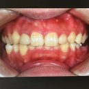 에스프라임치과의원 | 교정은? 부평 프라임에스치과교정과의원에서.