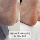 네일비타&푸스케어(건대점) | 건대발각질 제거! 네일비타&amp;푸스케어 건대점에서 해결했어요!