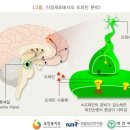 파킨슨병 [ Parkinson’s disease ] 이미지