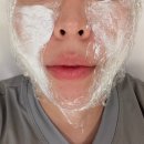 바로본 | 압구정역피부과 티타늄리프팅 다운타임 없이 바로 효과 본 후기