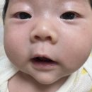 수동 | [메딧트] 신생아 콧물 코감기 수동 콧물흡입기 사용후기