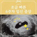 임신 6주차｜ 예민한 엄마의 임신 극초기 증상 (+해야할 일, 팁)