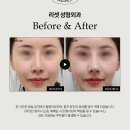 리셋성형외과의원 네이버블로그