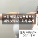 수원 인계동 지방분해 제로컷주사 팔뚝 3회차 후기