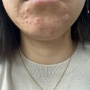 Yoonskin | [피부관리샵] 피부관리 추천 트러블삭제가 가능 한 나만 알고 싶은 곳 부산 "서면 윤스킨"