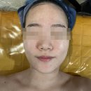 아띠랑스(Attirance) | 백운동 아띠랑스 스킨케어, 광주피부관리 #모공관리 #여드름관리 추천