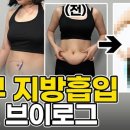 스카이쁘아뜨의원 이미지