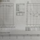 박은호이비인후과의원 | 돌발성 난청 투병일지 - 4 (최종)