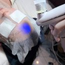 광주 중흥ㅣ독일 프리미엄 룩서스 플라즈마 후기ㅣ"멜로우 광주 전대점"